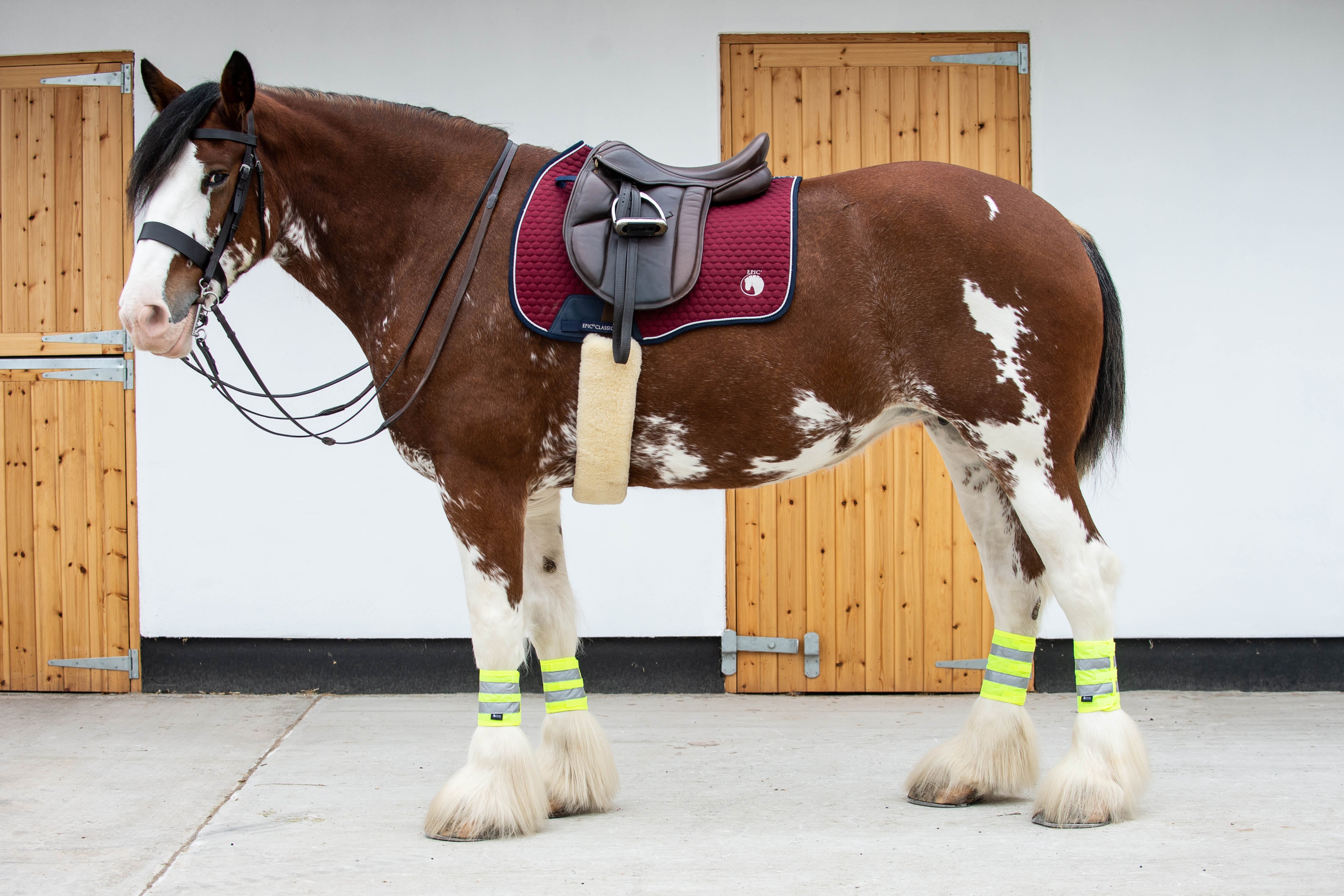 Epic Classic Fluorescent Leg Wraps